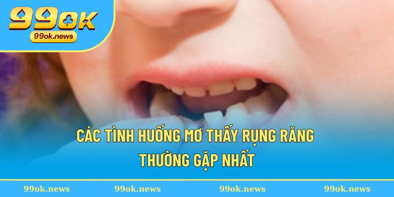 Các tình huống mơ thấy rụng răng thường gặp nhất Các tình huống mơ thấy rụng răng thường gặp nhất